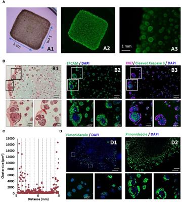 3D bioprinted CRC model brings to light the replication necessity of an oncolytic vaccinia virus encoding FCU1 gene to exert an efficient anti-tumoral activity